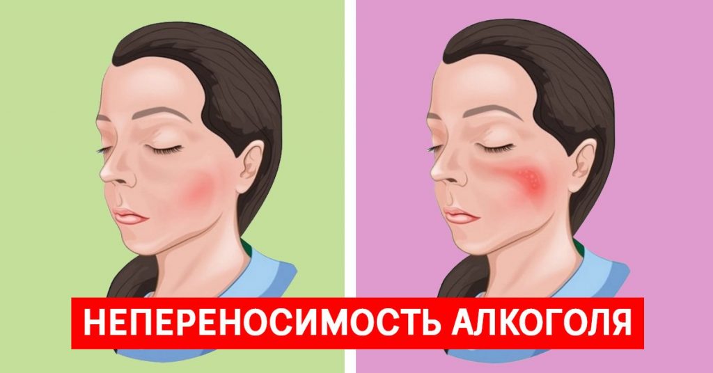 Непереносимость алкоголя: какие признаки и кто попадает в группу риска