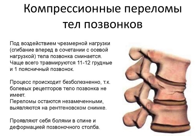 Почему у женщин поясница болит чаще, чем у мужчин