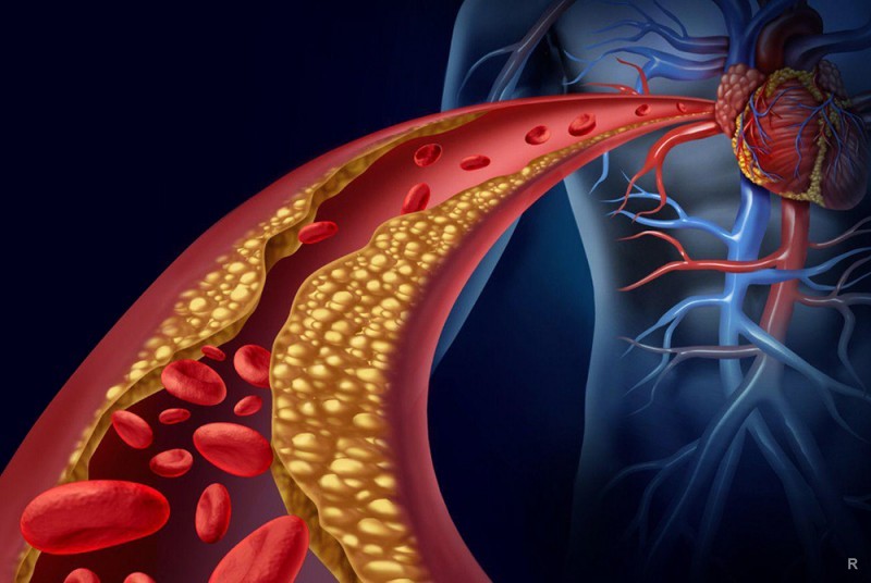 Медики назвали истинную причину возникновения опасных сердечно-сосудистых заболеваний